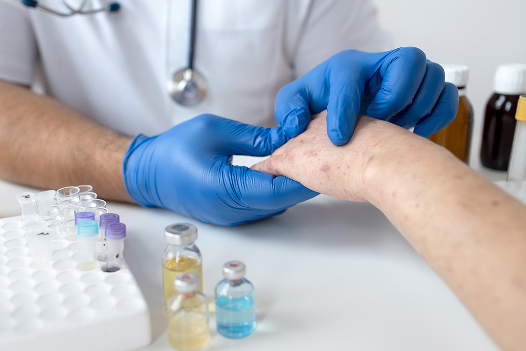 skin-allergy-person-s-arm.jpg skin-allergy-person-s-arm.jpg